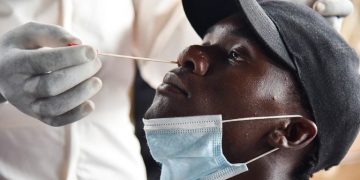 Le Cameroun abuse-t-il des tests PCR ?