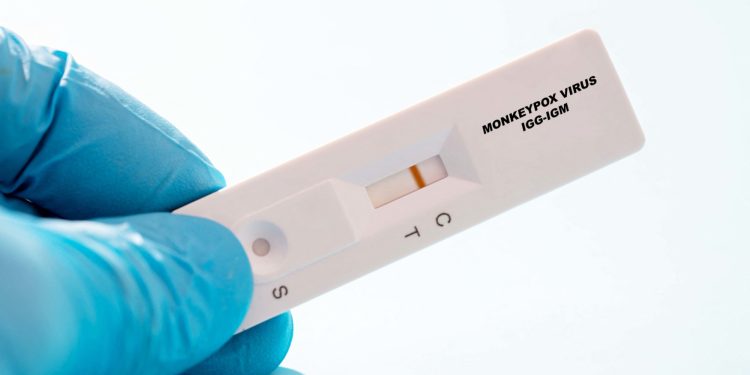 Epidemie-de-mpox-aussi-appele-variole-du-singe